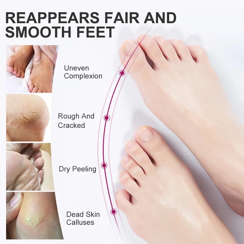 Foot Peel Mask, Exfoliating Peel Off Calluses Dead Skin Callus Remover Dry Cracked Feet, Baby Soft Smooth Touch Feet Skin