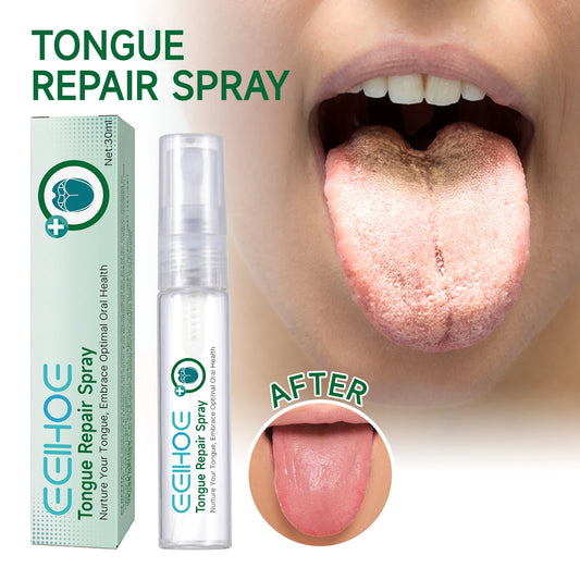 Tongue Moisturizing Spray,Repair White Tongue Coating,Relieve Dry and Swollen Tongue,Oral Care Spray