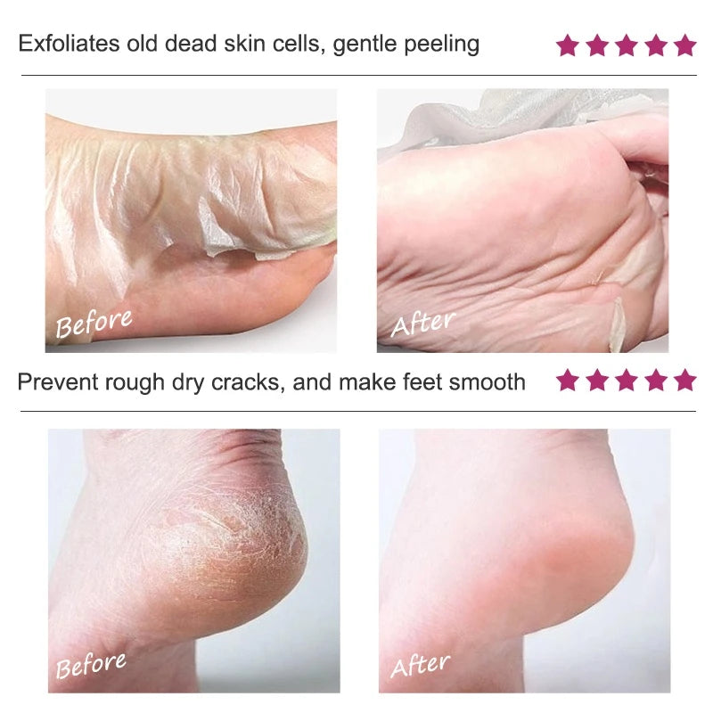 Foot Peel Mask, Exfoliating Peel Off Calluses Dead Skin Callus Remover Dry Cracked Feet, Baby Soft Smooth Touch Feet Skin